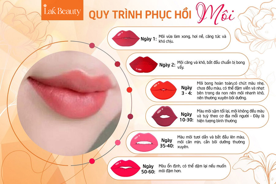 Quy trình phục hồi môi sau phun trải qua 6 giai đoạn