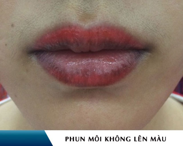 Môi bị thâm, không lên màu