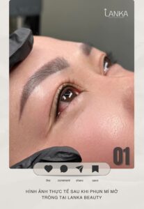 review phun mí mở tròng tại lanka beauty 01