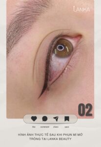 review phun mí mở tròng tại lanka beauty 02
