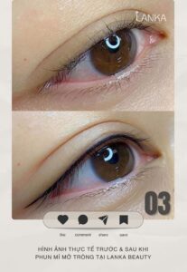 review phun mí mở tròng tại lanka beauty 03