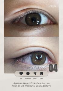 review phun mí mở tròng tại lanka beauty 04